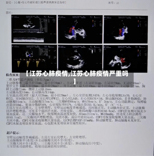 【江苏心肺疫情,江苏心肺疫情严重吗】-第1张图片