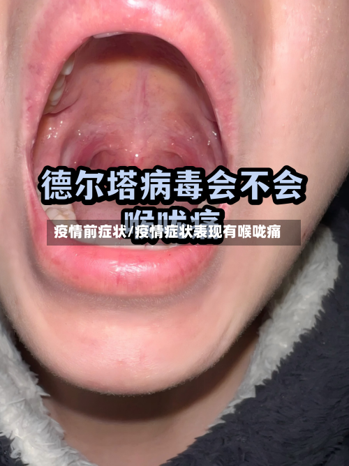 疫情前症状/疫情症状表现有喉咙痛-第2张图片